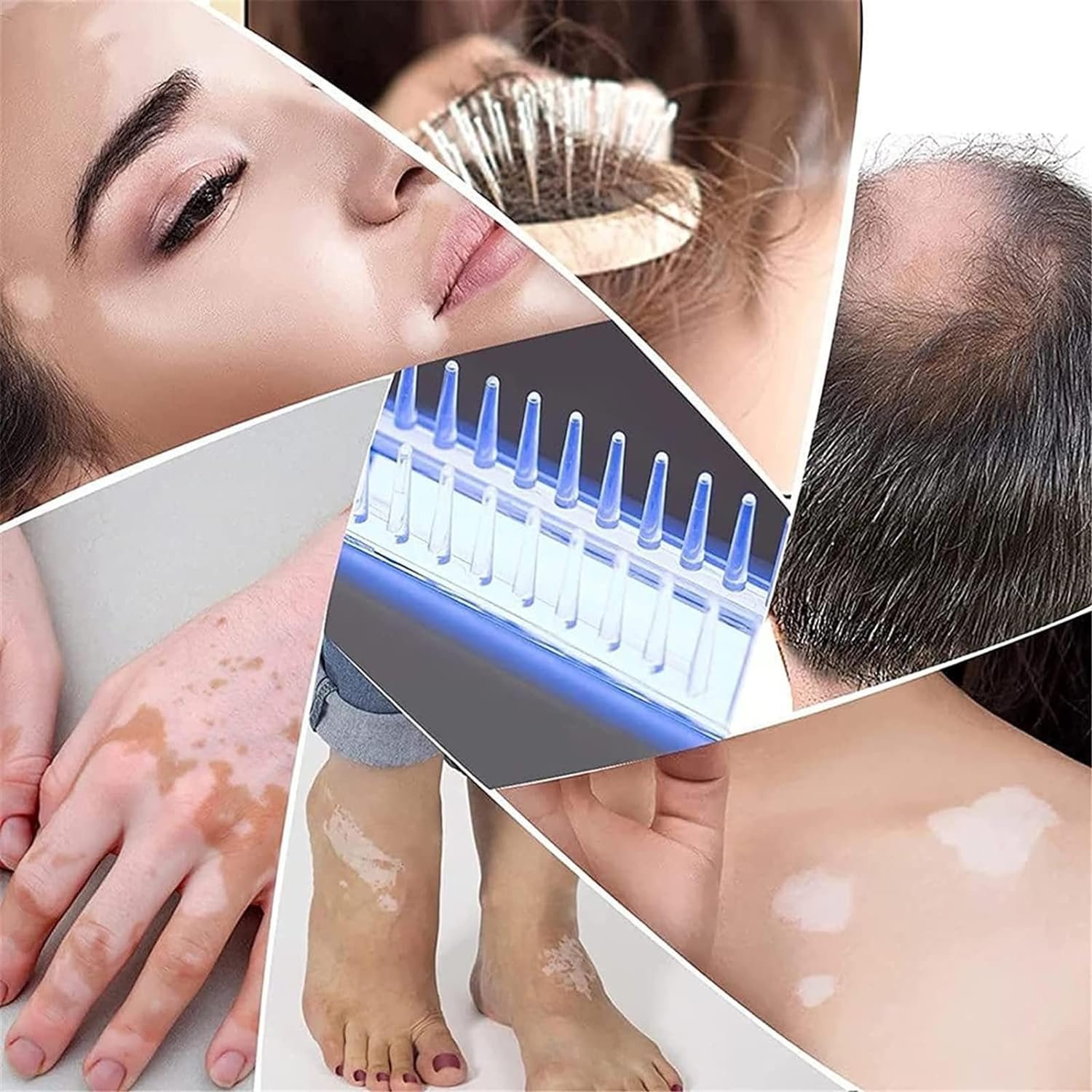 AAADRESSES LumièRe PhotothéRapie UV